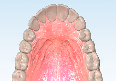 assets/images/glossary/maxillary.jpg